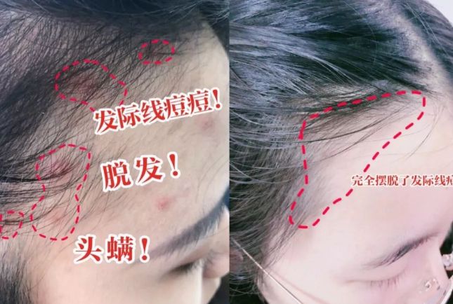 洗头干发神器！养出女明星绸缎发！冰球突破国产变态“抽水帽”入冬(图4)